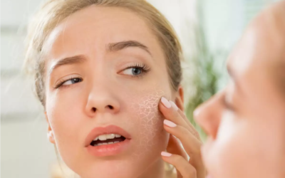 Moisturize Your Dry Skin With Therapy Lotion
